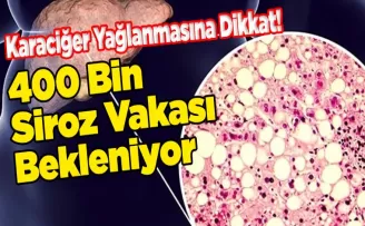 Karaciğer Yağlanmasına Dikkat!